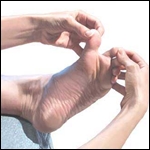 Actividades de prevención del pie diabético en pacientes de consulta externa de primer nivel. Rev. salud pública [online]. 2011