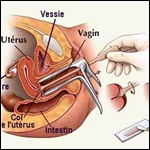 Estudio: Creencias sobre Papanicolaou y cáncer cérvicouterino en un grupo de mujeres chilenas 2012