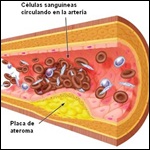 Guía de la ESC/EAS sobre el manejo de las dislipemias. Sociedad Europea de Cardiología (ESC) y de la Sociedad Europea de Aterosclerosis (EAS) 2011