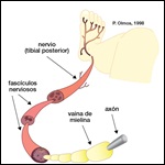 Ejercicio para personas con neuropatía periférica. Resúmenes Cochrane 2011