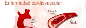 Factores de riesgo cardiovascular en estudiantes de enfermería de una universidad pública, Enfermería Universitaria- 2016