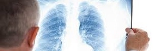 Vivir con la enfermedad pulmonar obstructiva crónica avanzada: el impacto de la disnea en los pacientes y cuidadores, Aten Primaria- 2016