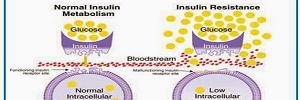 Omentina: papel en la resistencia a la insulina, inflamación y protección cardiovascular, Arch Cardiol Mex- 2016