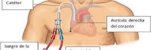 Prevención, diagnóstico y tratamiento de las infecciones relacionadas a líneas vasculares, México: instituto secretaria de salud- 2012