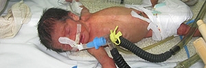 Guía para la ventilación mecánica del recién nacido, Servicio Andaluz de Salud- 2009