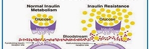 Metformina asociada a insulinoterapia en pacientes diabéticos tipo 1, Rev. chil. endocrinol. diabetes- 2015