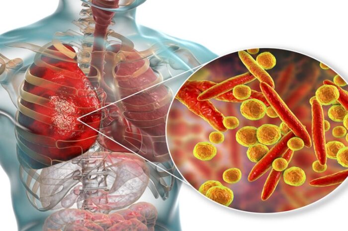 Seroprevalencia de anticuerpos anti-Mycoplasma pneumoniae en niños menores de 12 años Rev Chil Pediatr. 2020